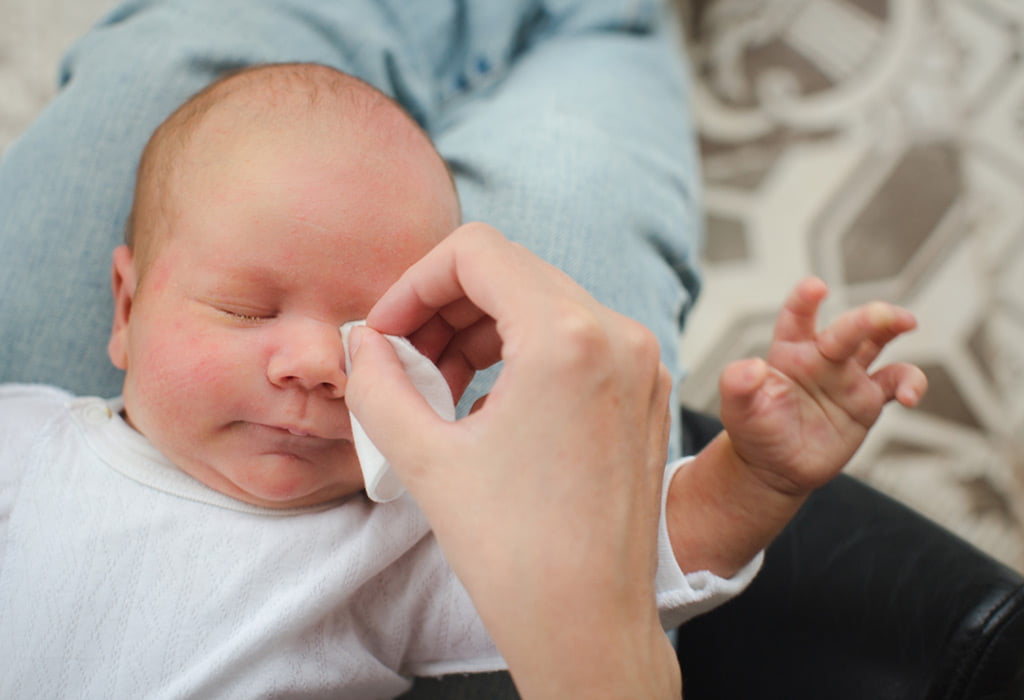 انسداد القناة الدمعية عند الرضع مشكلة تواجه بعض الرضع .. فما هي أسبابها ...