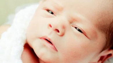 العماص عند الرضع