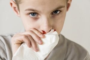 علاج نزيف الأنف عند الأطفال
