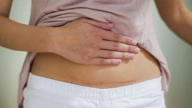 تنميل البطن بعد الولادة القيصرية