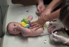 التطعيم الثلاثي البكتيري للأطفال